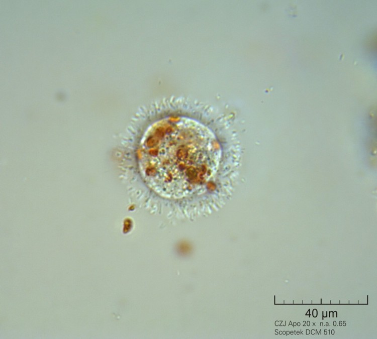 Amoeba Nuclearia   -  Nuclearia simplex